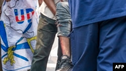 La jambe blessée d'un homme est vue lors d'une manifestation où des manifestants et des policiers se sont affrontés à Kinshasa le 9 juillet 2020. (Photo by Arsene Mpiana / AFP)