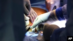 Surgeons perform the world’s first genetically modified pig kidney transplant into a living human at Massachusetts General Hospital, in Boston, March 16, 2024. (Massachusetts General Hospital via AP)