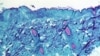 HEALTH-MONKEYPOX/