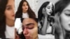غزل رنجکش بینایی چشم راستش را بر اثر اصابت گلوله ساچمه‌ای از دست داد (عکس از صفحه اینستاگرام غزل رنجکش)