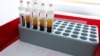 Blood samples are prepared for testing for the corona virus at a laboratory in Berlin, Germany, March 26, 2020.