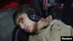 An injured boy waits for treatment in a field hospital after what activists said was an airstrike by forces loyal to Syria's President Bashar al-Assad in the Duma neighborhood of Damascus, Dec. 23, 2014. 