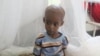 WFP Makes Emergency Airlifts to Mogadishu with Specialized Nutritional Food