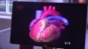 Implantable Heart Defibrillators Deliver Shock in More Ways Than One