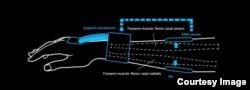 This drawing of Vigor illustrates how the device can give muscles an additional boost to help complete movements such as bending the wrist.