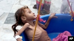 FILE - In this Aug. 25, 2018 file image made from video, a severely malnourished girl is weighed at the Aslam Health Center in Hajjah, Yemen. The U.N. food agency said Wednesday, Sept. 19, 2018, that time is running out for aid groups operating in Yemen to prevent a devastating famine in the war-torn country. The World Food Program said what’s urgently needed to prevent famine is new entry points for humanitarian and commercial food imports to address what it calls a “growing hunger strike” across the impoverished Arab nation. 