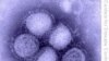Health Officials Warn of Sicker Swine Flu Patients