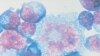 Color-Coded HIV Test Detects Infection Quickly and Cheaply