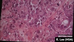 Artificial intelligence through machine learning can detect complex patterns in cell arrangement that would be difficult for humans to recognize.