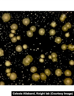 The microbes in the human body include bacteria, viruses and fungi, like E. Coli shown here. Each person's microbes are unique to that person.