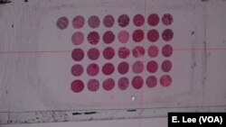 High resolution slide scanners plus stronger computer power allows for the possibility for AI to help doctors more accurately figure out the subtype of breast cancer a patient has.