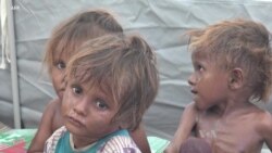 UN Official Warns of Imminent Great Hunger in Yemen
