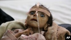 آرشیف: حدود ۲.۲ میلیون کودک در یمن از سو تغذی رنج می برند و نیم از آنان با سو تغذی شدید مواجه اند