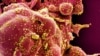 This colorized image captured by the NIAID Integrated Research Facility shows an apoptotic cell (red) infected with SARS-COV-2 virus particles (yellow), also known as novel coronavirus, isolated from a patient sample.
